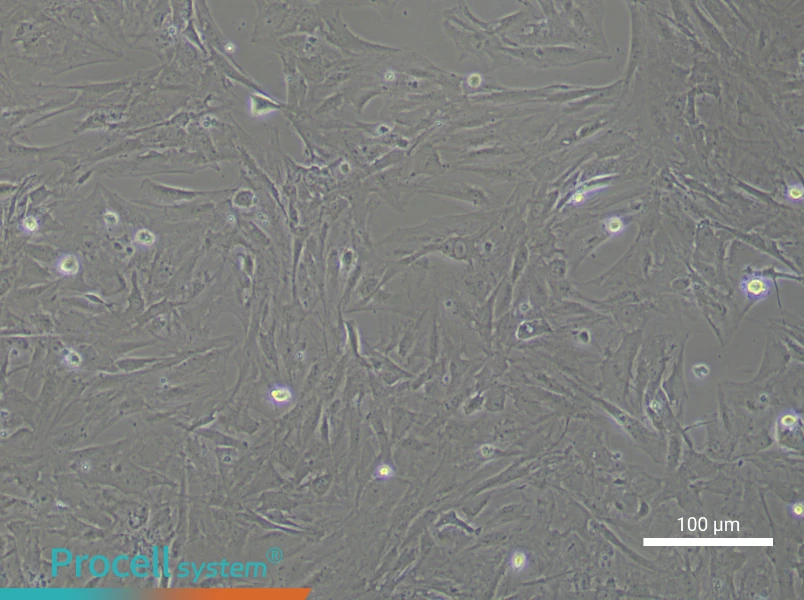 Mouse Brain Microvascular PericytesMouse Brain Microvascular Pericytes - 3
