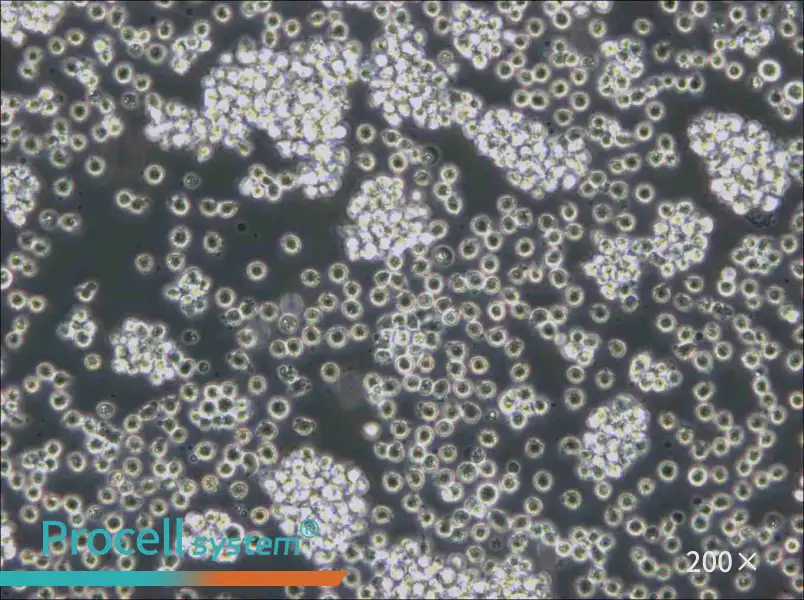 WSU-DLCL2 Cell Complete Medium - small - 5