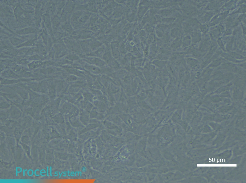 Rat Bronchial Fibroblast Complete Medium - 4