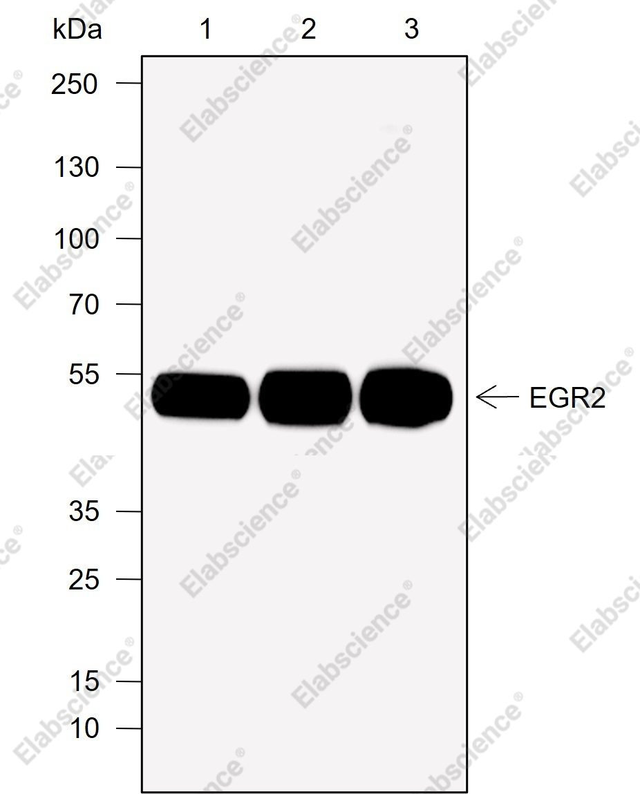 Recombinant EGR2 Monoclonal Antibody - 1