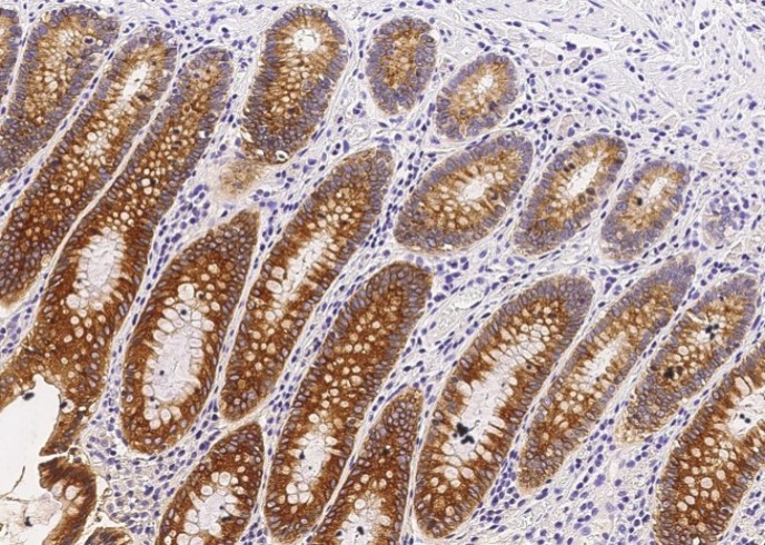 Recombinant CES3/Carboxylesterase 3 Monoclonal Antibody - small - 2