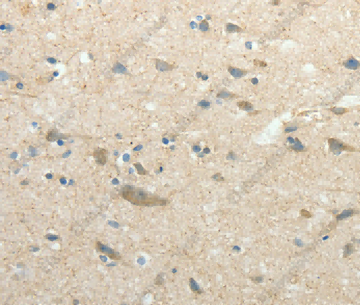 SIRT3 Polyclonal Antibody - 3