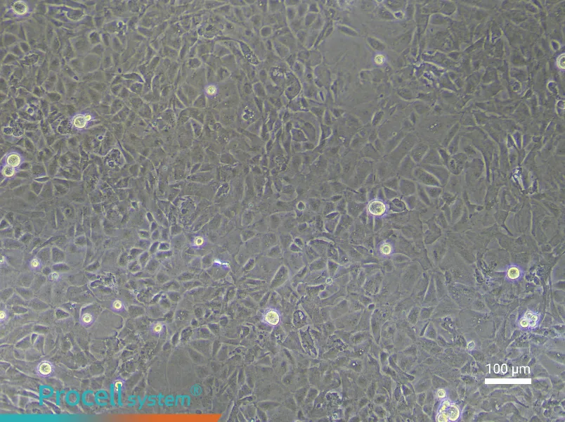 Rat Pulmonary Microvascular Endothelial Cell Complete Medium - 1