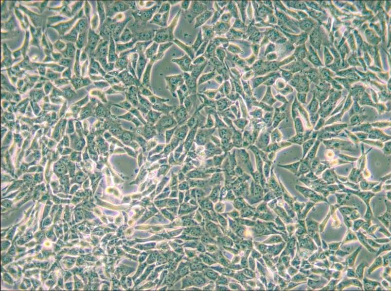 SUM159PT Cell Complete Medium - small - 4