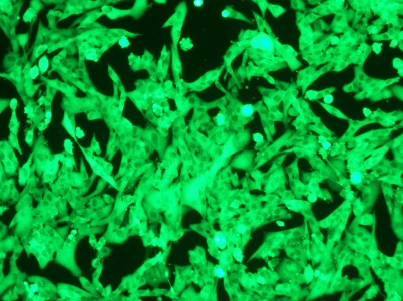 NCI-H446-GFP Cell Complete Medium - small - 11