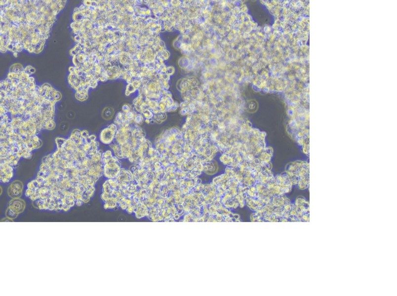NCI-H187 Cell Complete Medium - 6