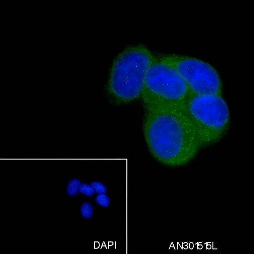 Recombinant EPHB4 Monoclonal Antibody - 3