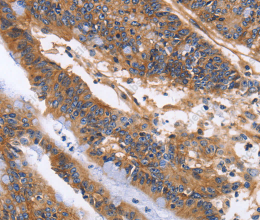 ITGB1 Polyclonal Antibody - 3