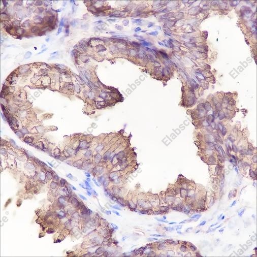 Recombinant PAP Monoclonal Antibody - 2
