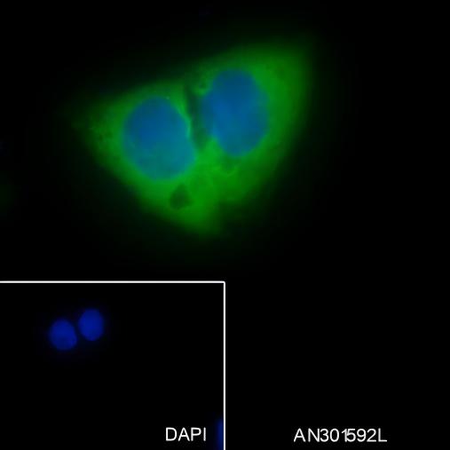 Recombinant LysRS Monoclonal Antibody - small - 5