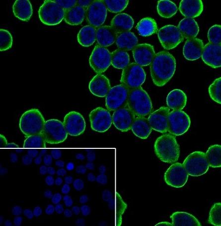 Recombinant IL-7R/CD127 Monoclonal Antibody-searchlist-1