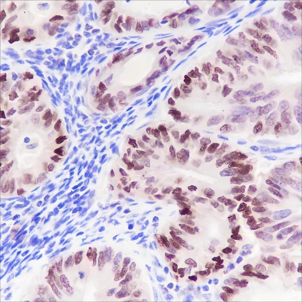 Recombinant BAF60C Monoclonal Antibody - small - 2