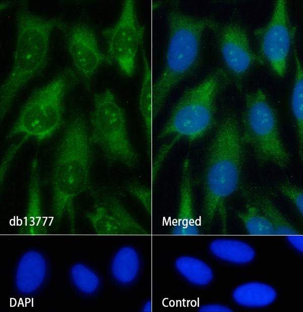 Recombinant NGF/NGFB Monoclonal Antibody - 2