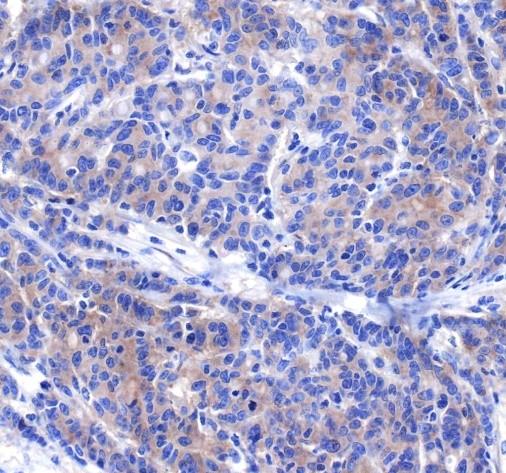 Recombinant DR5 Monoclonal Antibody-searchlist-2