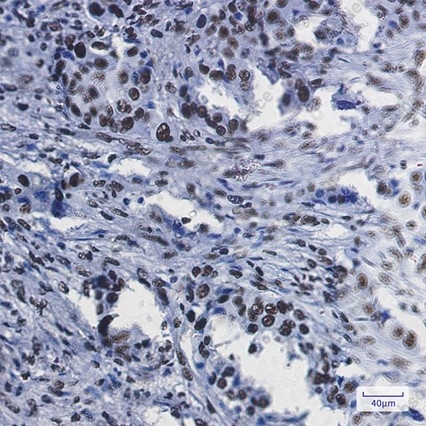 Recombinant RBBP4 Monoclonal Antibody - 3