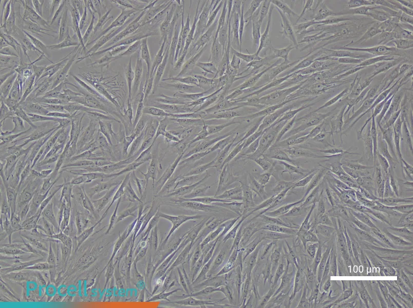 Human Pulmonary Artery Smooth Muscle Cell Complete Medium - 1