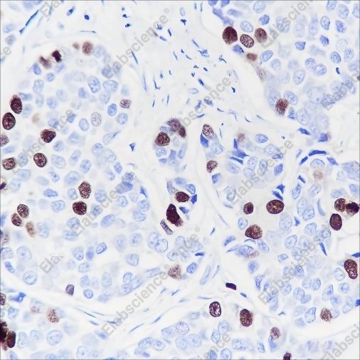Recombinant TPX2 Monoclonal Antibody - 8