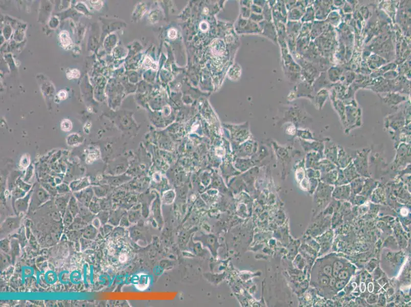 OV-90 Cell Complete Medium - small - 6