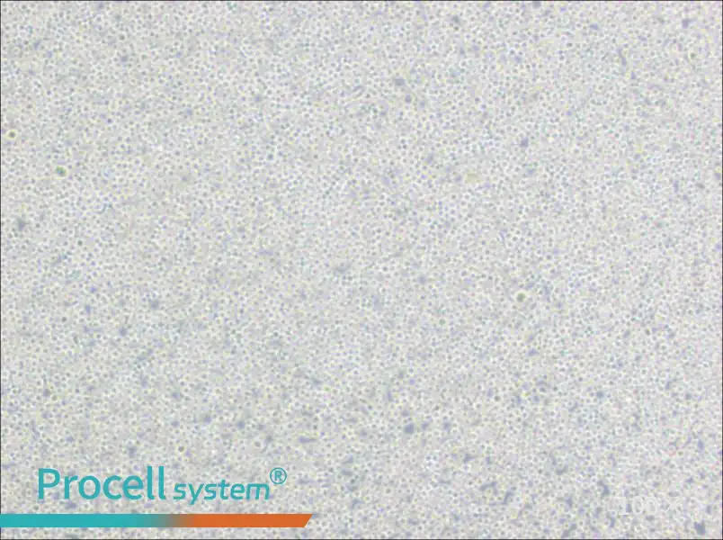 BALL-1 Cell Complete Medium - 1