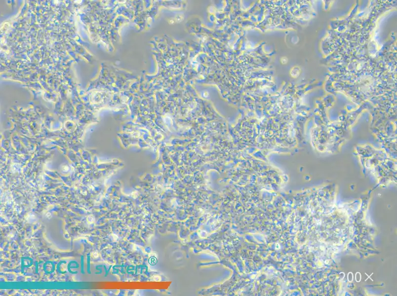 LS 174T [LS174T] Cell Complete Medium - small - 5