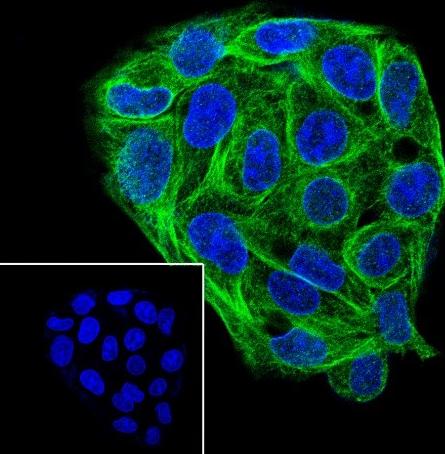 Recombinant ELP4 Monoclonal Antibody - 2