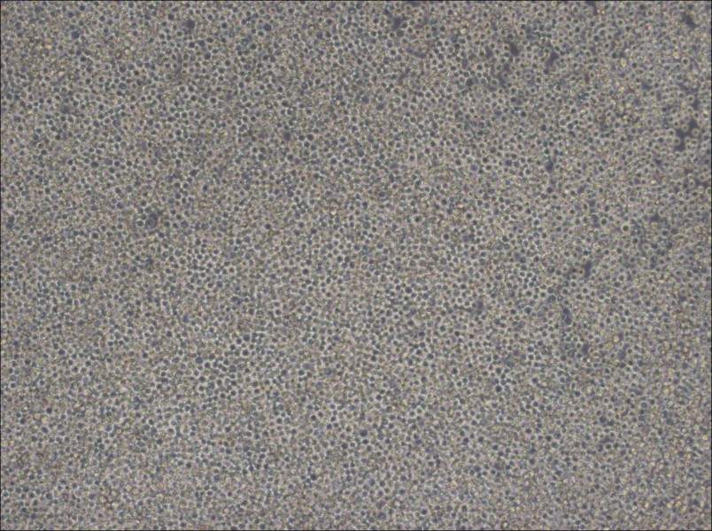 MOLM-13 Cell Complete Medium - 3