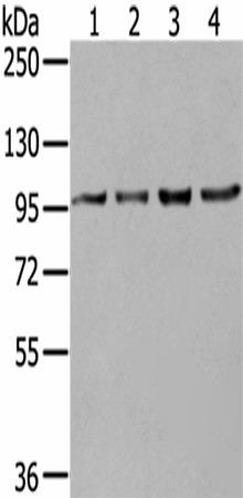 Western Blot analysis of K562, 293T, 231 and Hela cells using NUP98 Polyclonal Antibody at dilution of 1/550