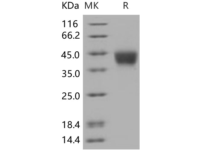 Recombinant Human CD200 Protein(His Tag)-1