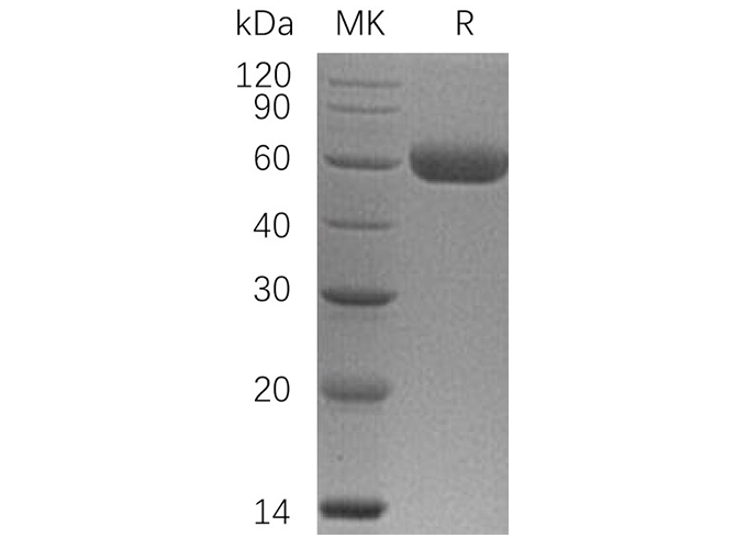 Recombinant Human Osteoprotegerin/TNFRSF11B Protein (His Tag)(Active)