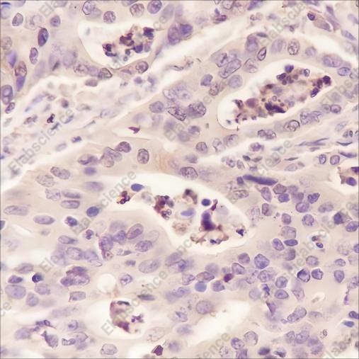 Recombinant ALDOA Monoclonal Antibody - 2