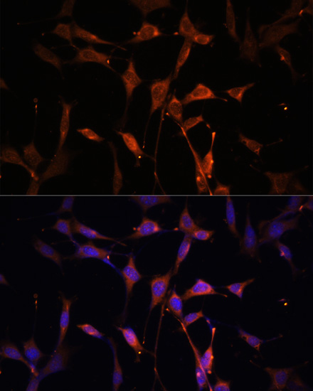 Immunofluorescence analysis of NIH/3T3 cells using KEAP1 Polyclonal Antibody at dilution of  1:100. Blue: DAPI for nuclear staining.