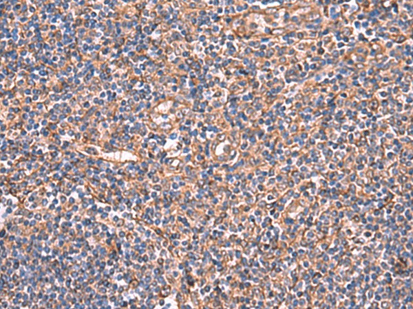 Immunohistochemistry of paraffin-embedded Human tonsil tissue  using TTC38 Polyclonal Antibody at dilution of 1:50(?200)