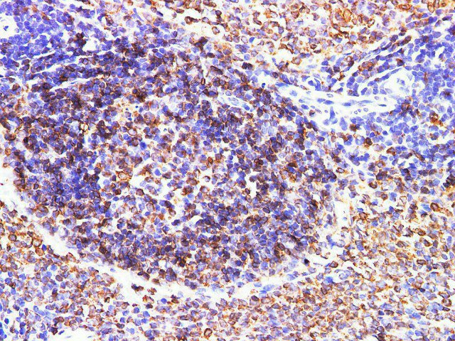 Immunohistochemistry of paraffin-embedded Rat spleen  using CD74 Polyclonal Antibody at dilution of 1:200