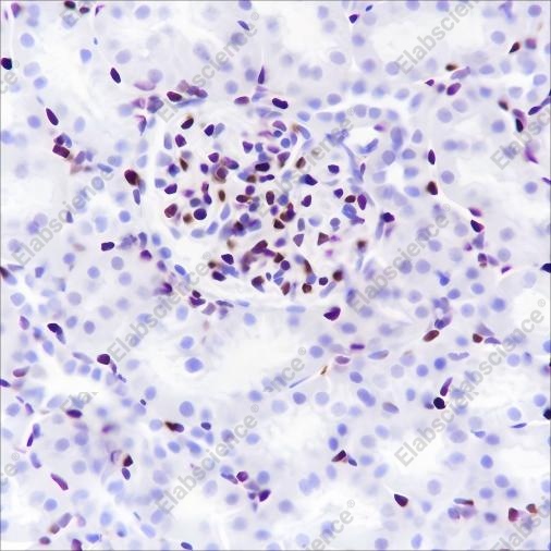 Recombinant ERG Monoclonal Antibody - 5