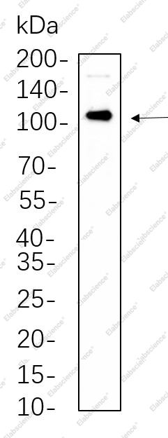 Recombinant Androgen Receptor Monoclonal Antibody - 1