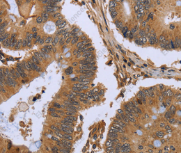 FHL2 Polyclonal Antibody - 3
