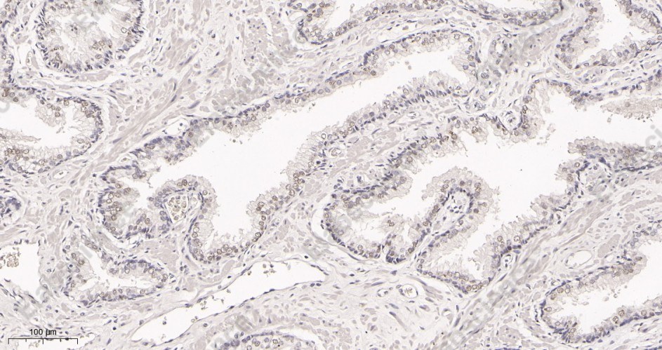 Recombinant METTL3 Monoclonal Antibody - 3