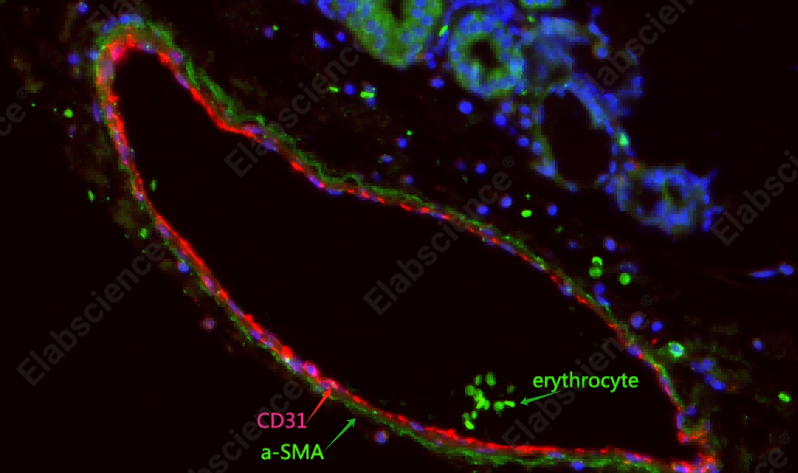 Recombinant α smooth muscle actin Monoclonal Antibody - 8