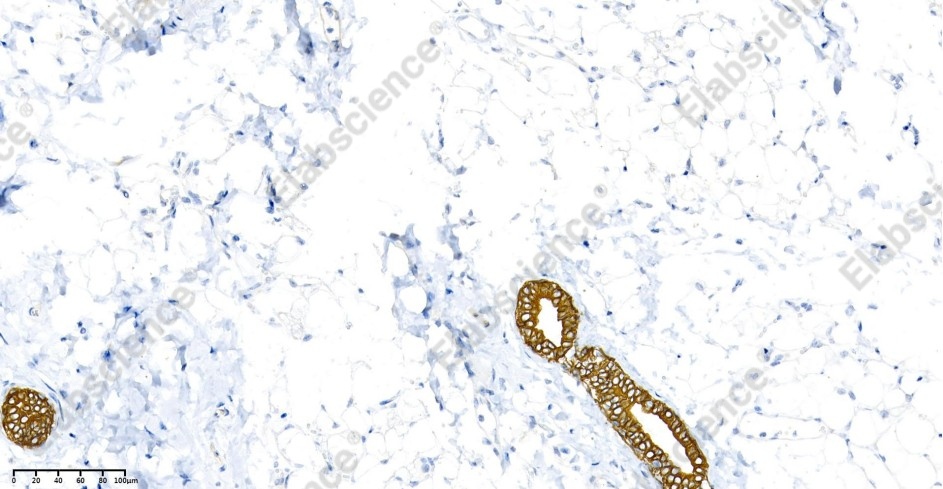 Recombinant Cytokeratin 8 Monoclonal Antibody - 2