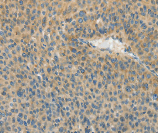 ASPA Polyclonal Antibody - 2