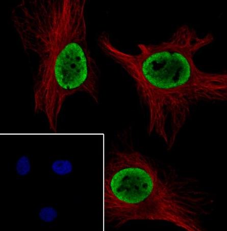 Recombinant RING1B Monoclonal Antibody - small - 5