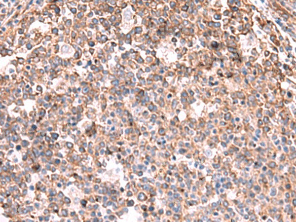 Immunohistochemistry of paraffin-embedded Human tonsil tissue  using KBTBD11 Polyclonal Antibody at dilution of 1:35(?200)