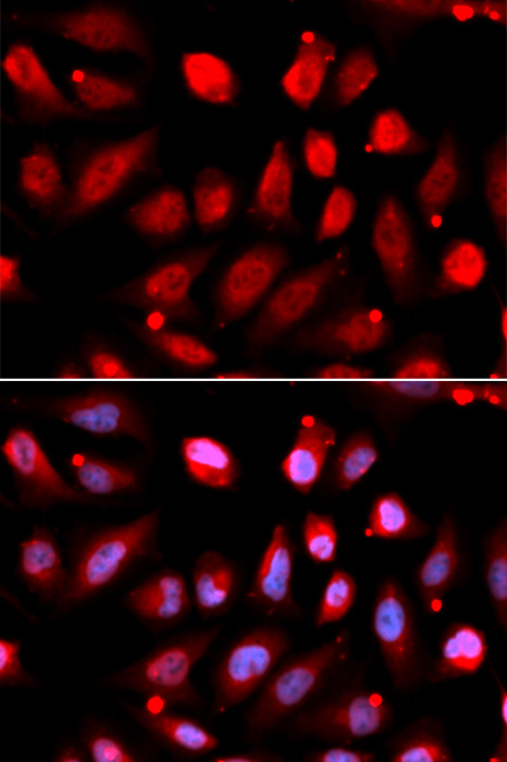 Immunofluorescence analysis of U2OS cells using EZH2/KMT6 Polyclonal Antibody