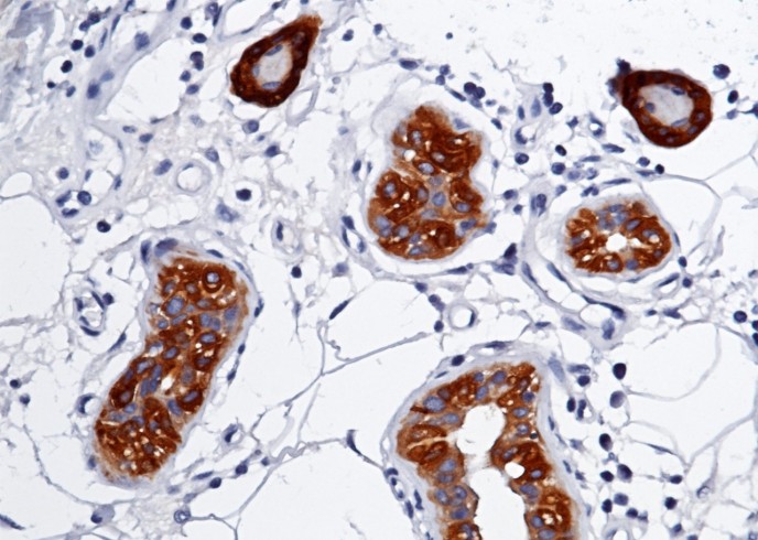 Recombinant S100A7 Monoclonal Antibody - small - 2