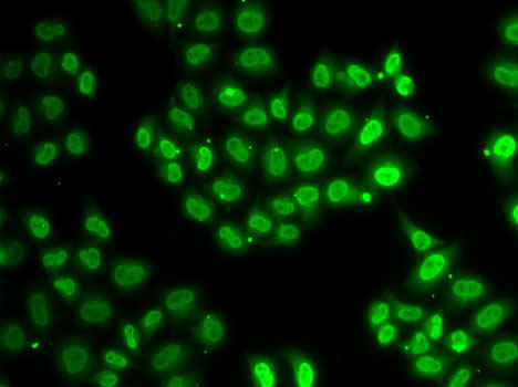 Immunofluorescence analysis of U2OS cells using EWSR1 Polyclonal Antibody