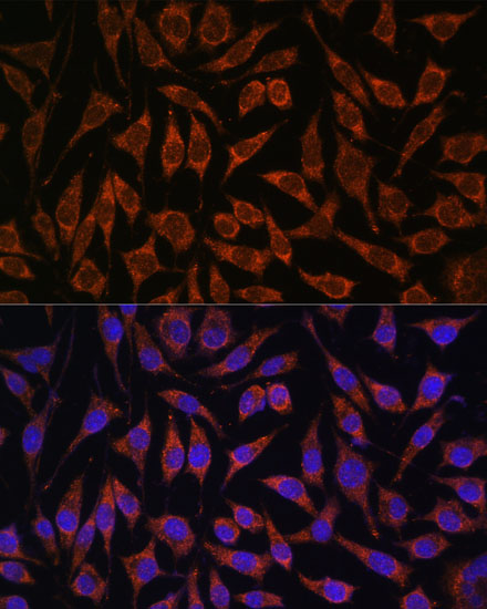 Immunofluorescence analysis of L929 cells using PASK Polyclonal Antibody at dilution of  1:100. Blue: DAPI for nuclear staining.