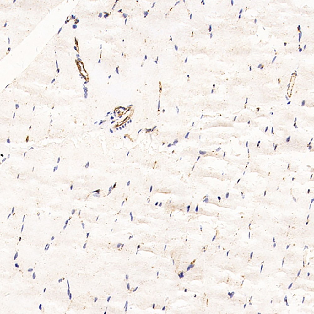 Immunohistochemistry analysis of paraffin-embedded Rat skeletal muscle   using CD31 Monoclonal Antibody at dilution of 1:200.