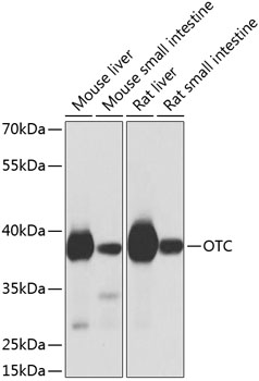 Western blot analysis of extracts of various cell lines using OTC Polyclonal Antibody at 1:1000 dilution.