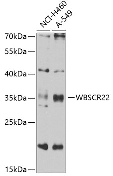 Western blot analysis of extracts of various cell lines using WBSCR22 Polyclonal Antibody at 1:1000 dilution.