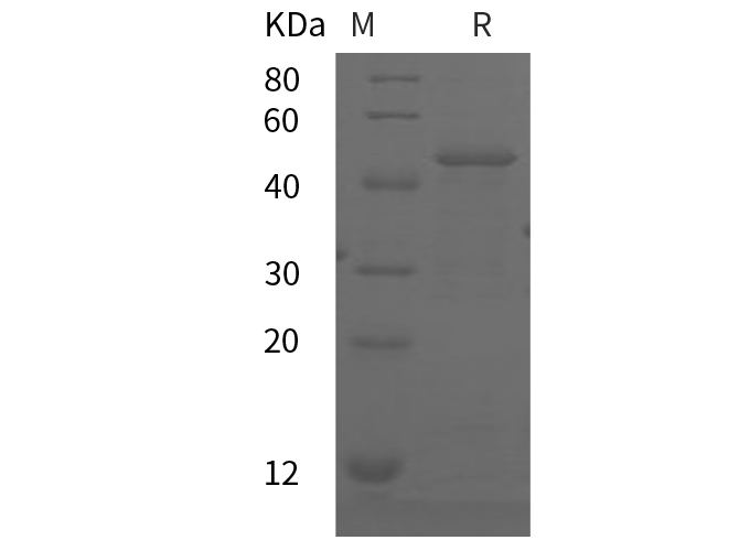 Recombinant Human CSF2 Protein-产品推荐-1